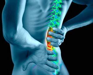 نشانههای ابتلا به دیسک کمر