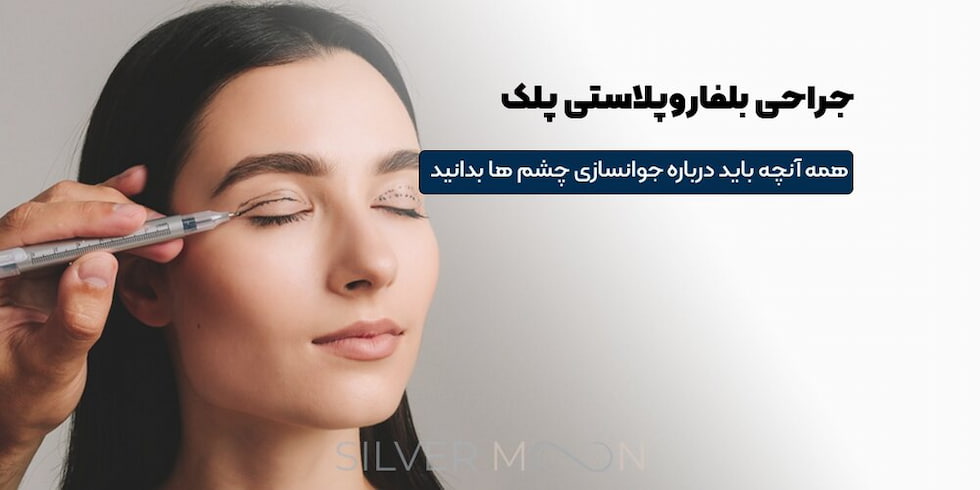 بلفاروپلاستی