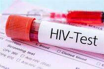آگاهی، تشخیص، درمان، سه رکن اساسی مقابله با HIV