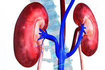 علائم بیماری های کلیوی