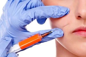 تزریق ژل لب بهتر است یا تزریق چربی