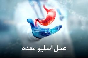 هزینه عمل اسلیو معده با بیمه تکمیلی | شرایط و میزان پوشش بیمه ‌های مختلف