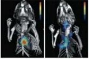 نانوذراتی که مانع التهاب بعد از حمله قلبی می‌شود