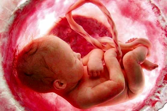 غربالگری جنین، مسابقه ماراتون پرخرج !