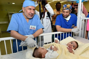 جداسازی دوقلوهای به‌هم‌چسبیده در عربستان + فیلم