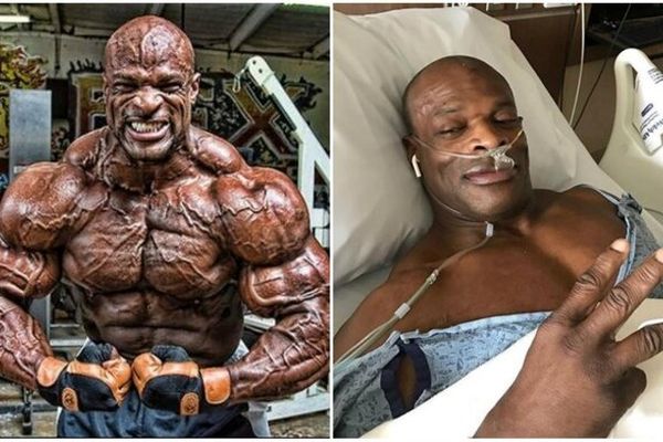 آخرین وضعیت رونی کلمن در بیمارستان/ حال “پادشاه” وخیم است