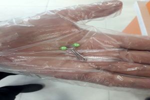 اورژانس قم جان کودک یک ساله را نجات داد