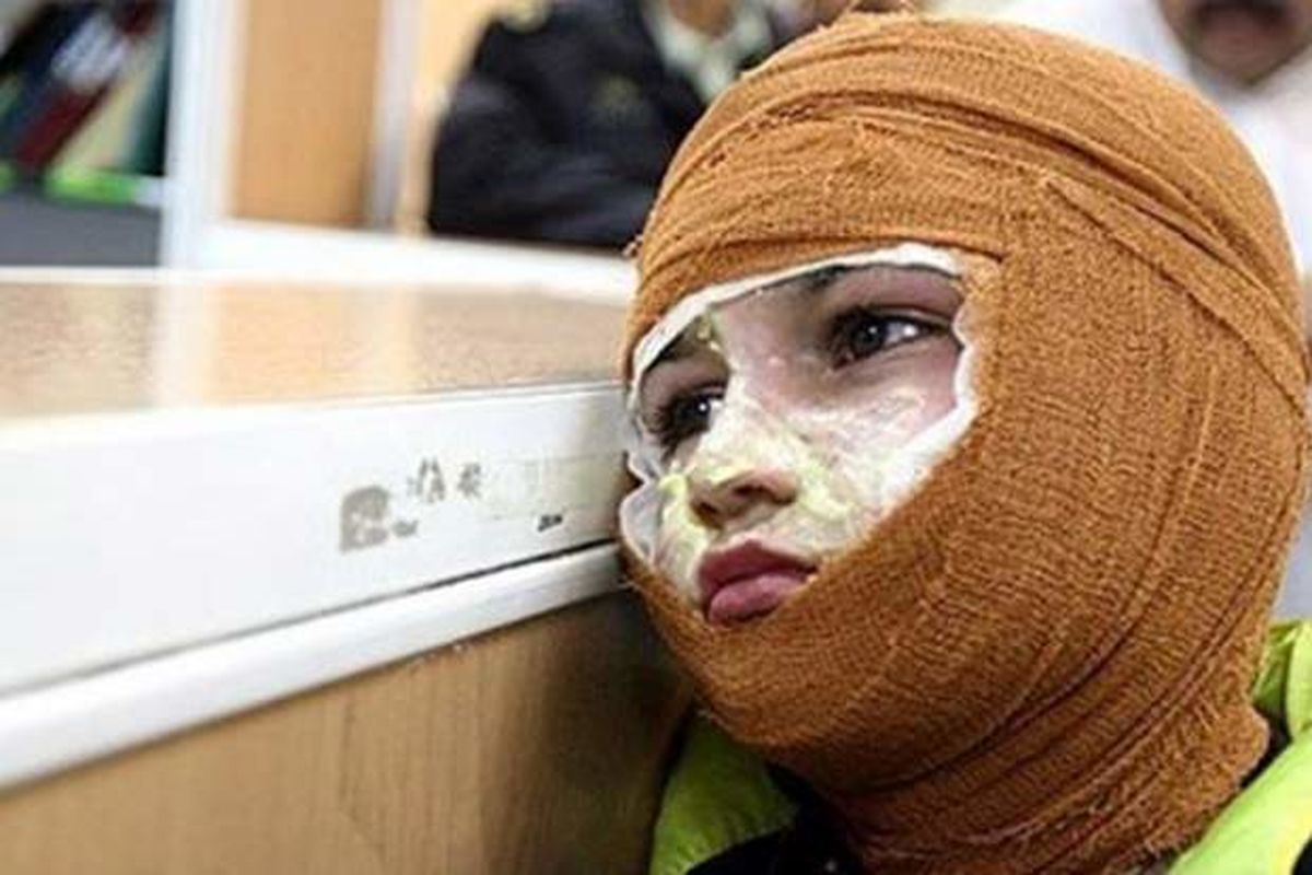 مصدومیت مواد محترقه