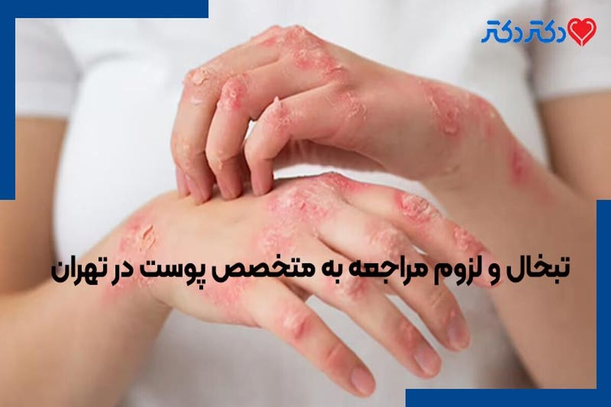 پوست