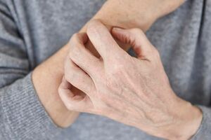 اگزما چیست و چه علائمی دارد؟