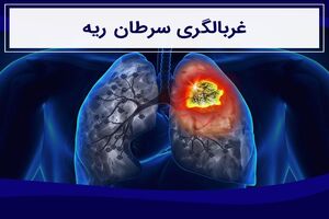 غربالگری سرطان ریه!