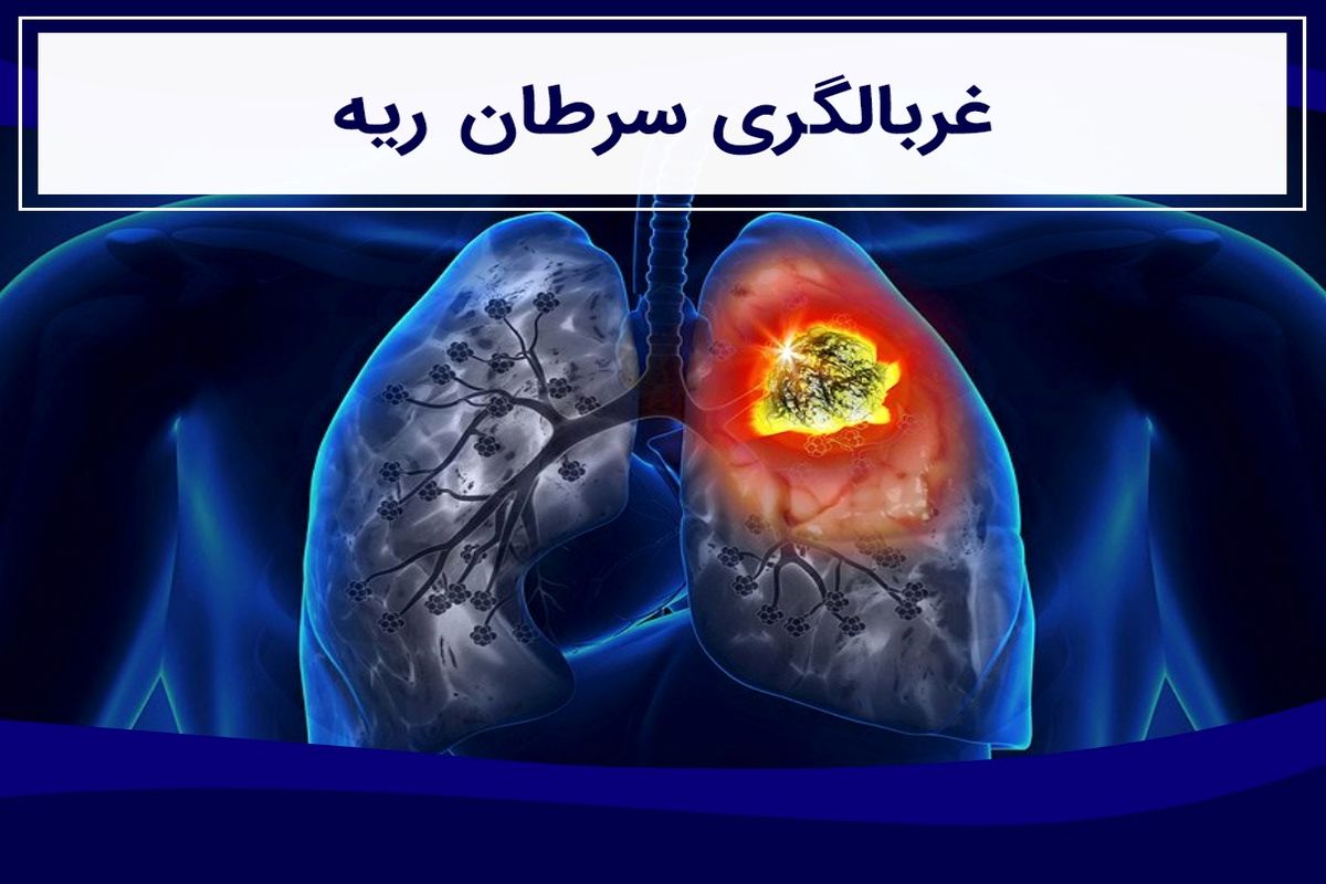 سرطان ریه
