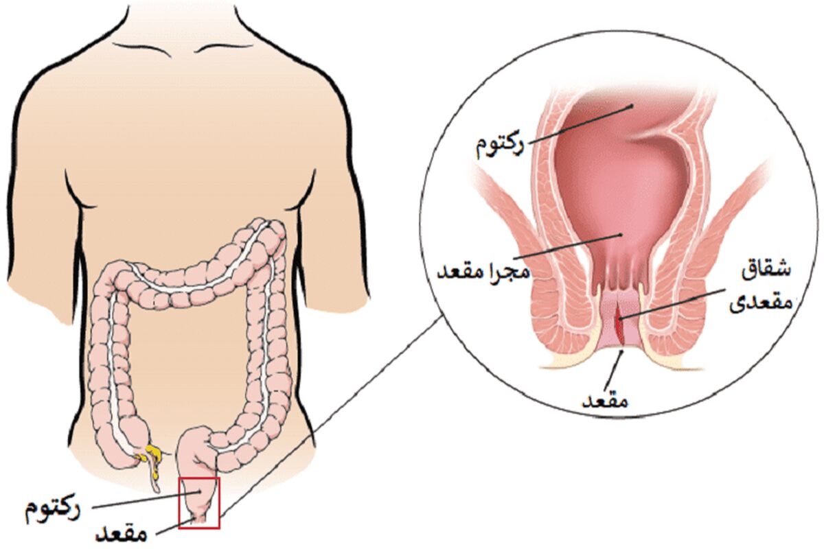 شقاق