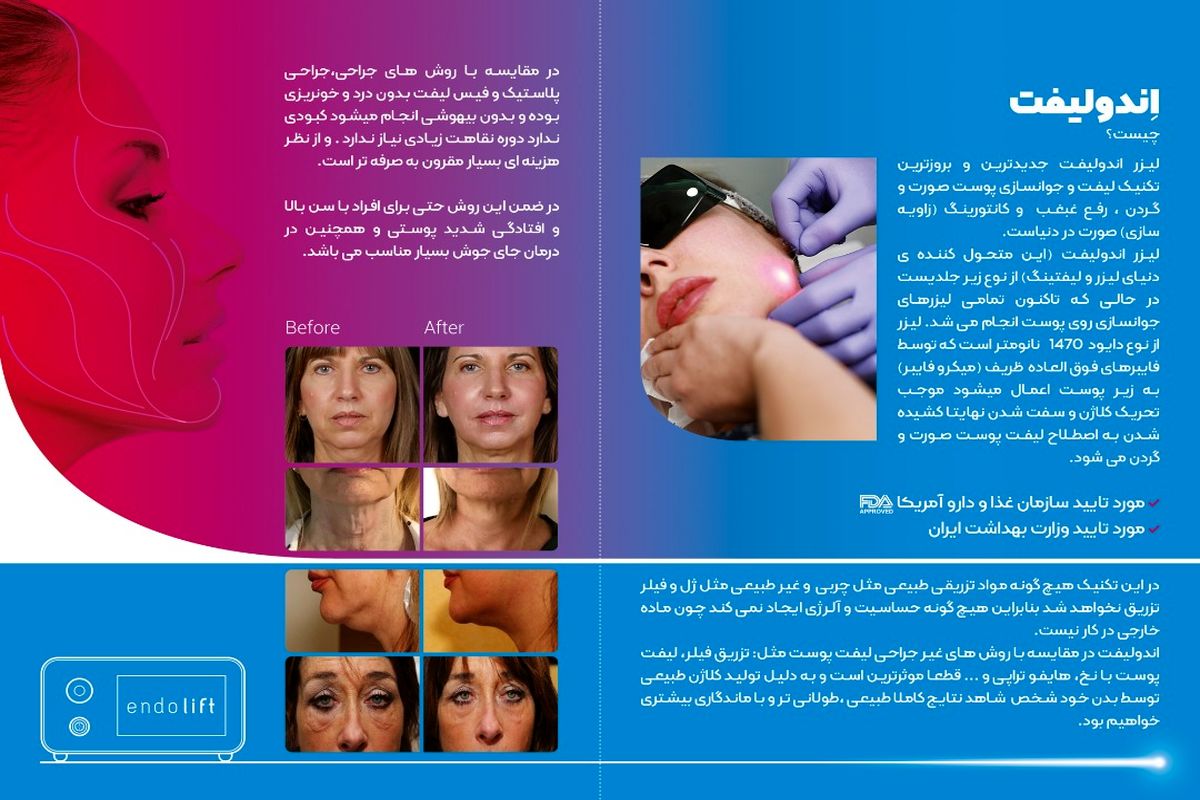 شرکت آریا لیزر