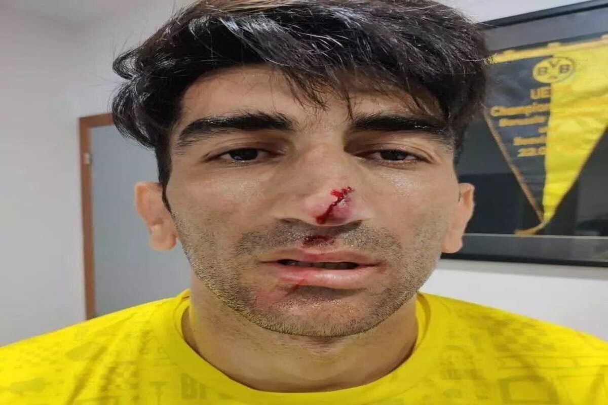 علیرضا بیرانوند