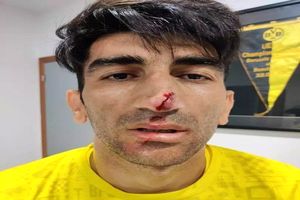 غیبت ادامه‌دار بیرانوند در تمرین تیم ملی فوتبال ایران