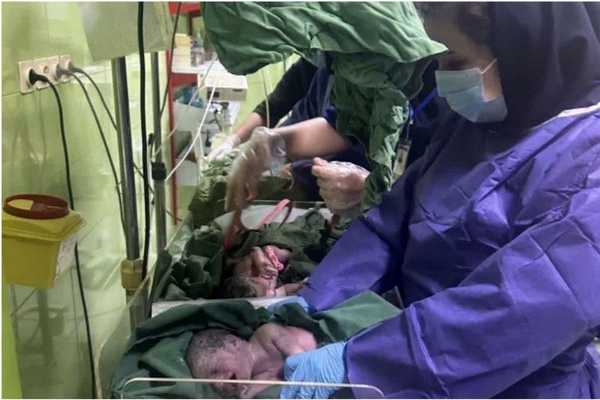 تولد نوزاد چهارقلو در اردبیل