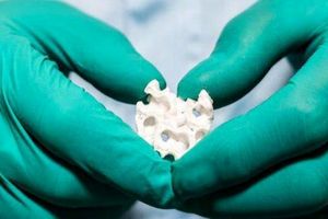 دانشمندان ایرانی موفق به ساخت بافت استخوانی شدند