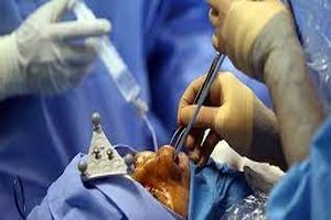 ممنوعیت عمل جراحی زیبایی توسط پزشکان عمومی با رای دیوان عدالت اداری برداشته شد