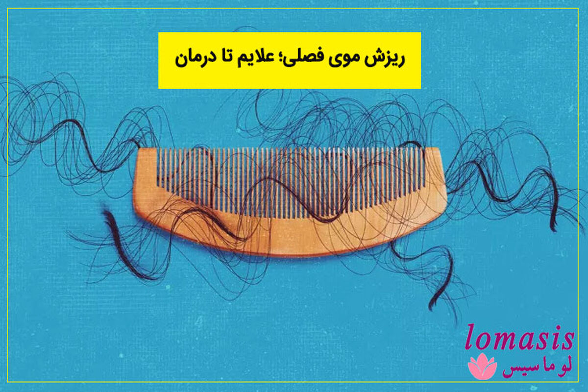 ریزش مو