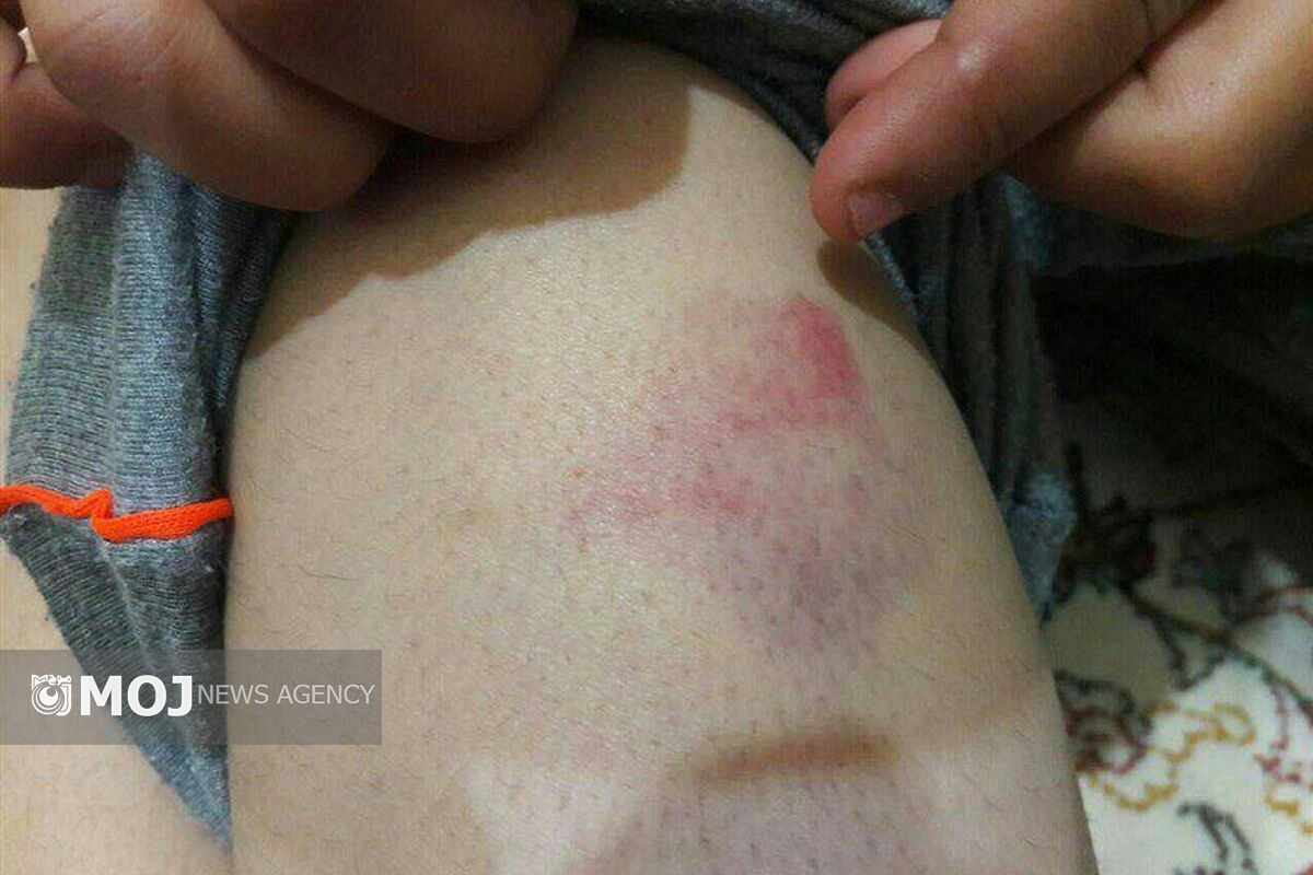 ضرب و شتم دانش آموز مدرسه انوشیروان رضایی خرم آباد