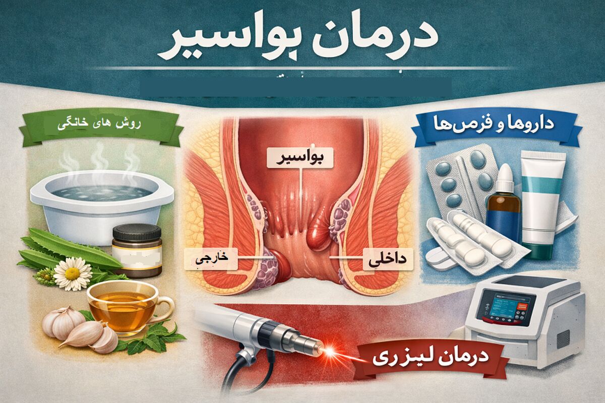 درمان بیرون‌زدگی بواسیر