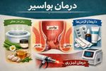 درمان بواسیر؛ راهنمای جامع روش‌های خانگی، دارویی و لیزری