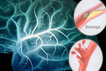 فرخ نژاد و استخری سفیران سلامت/ سکته مغزی دومین عامل مرگ‌ومیر در کشور است