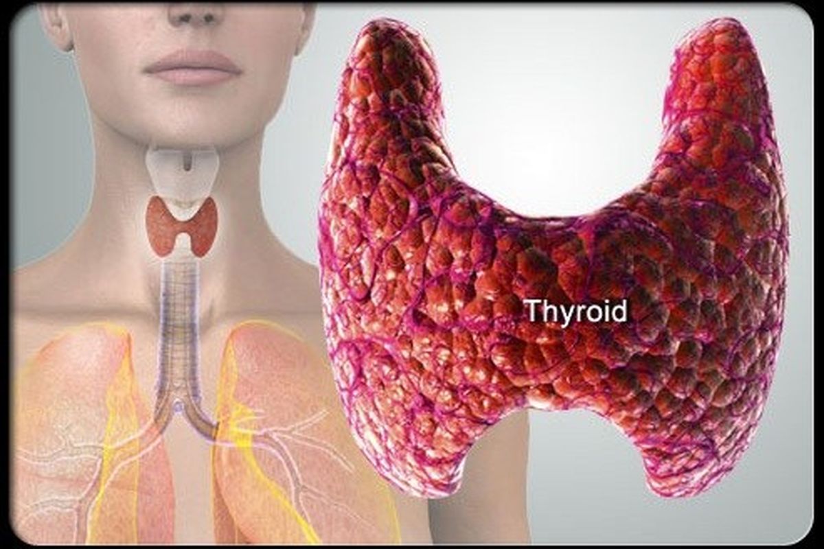 سرطان تیروئید