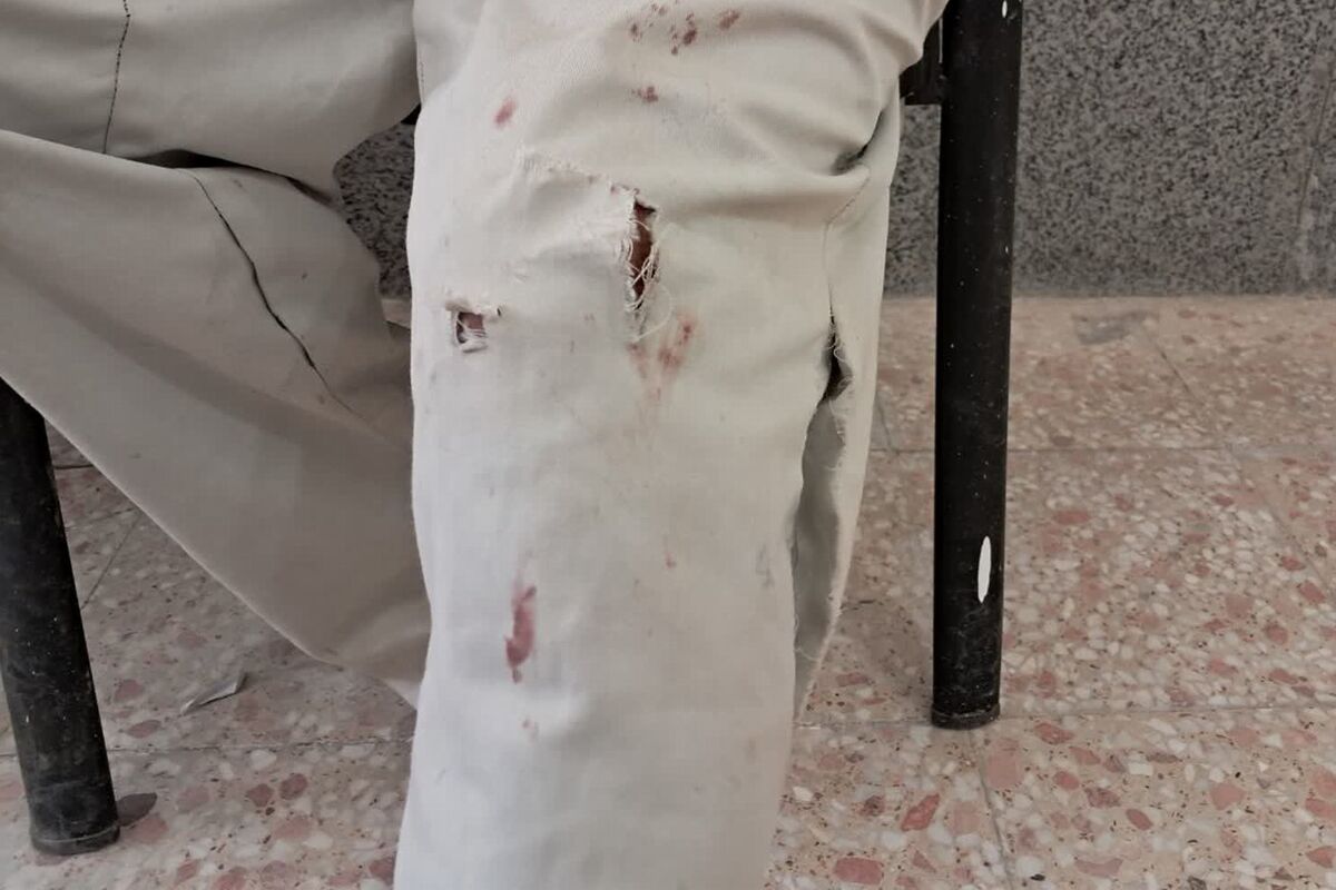 سگ هار