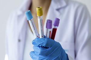 4 نماینده مجلس و 1 وزیر در فرانسه به کرونا مبتلا شدند