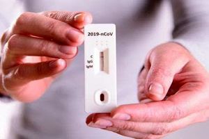 تامین 361 هزار کیت تشخیص کرونا در نوروز ۱۴۰۰