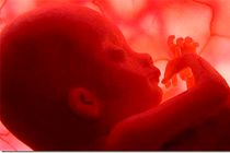 کاهش سریع باروری، عامل اصلی رشد سالخوردگی در ایران است