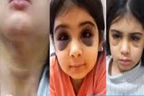 ورود دادگستری کردستان به ماجرای ضرب و شتم آنیلا