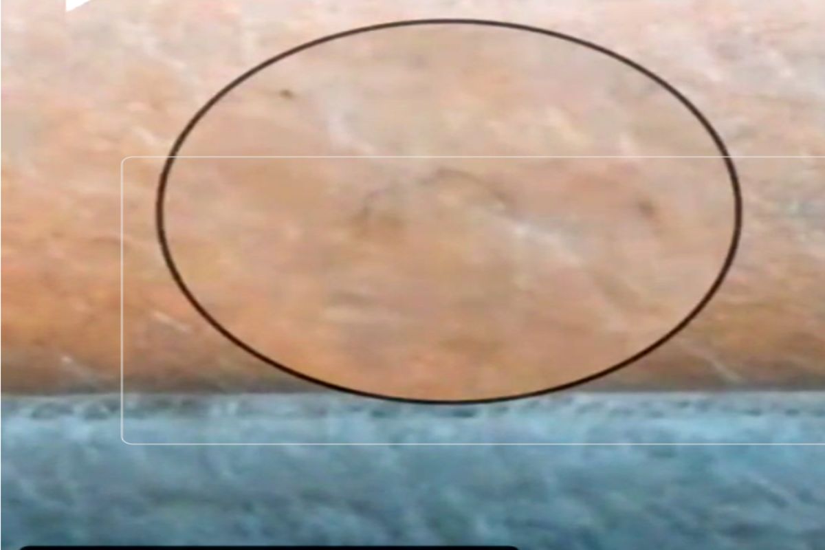 ماسک های آلوده