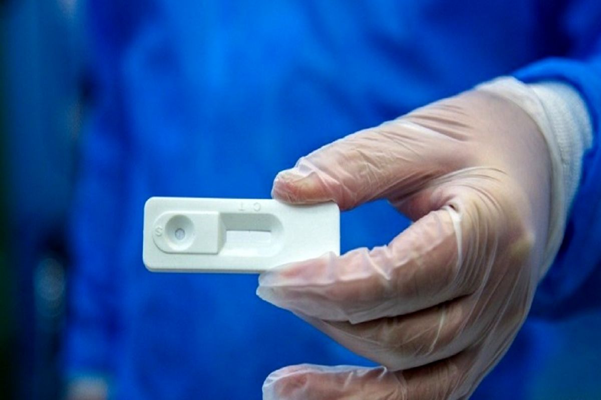 کیت‌های تشخیصی بیماری کرونا