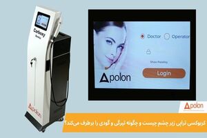 کربوکسی‌ تراپی زیر چشم چیست و چگونه تیرگی و گودی را برطرف می‌ کند؟