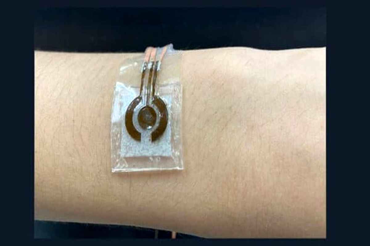 حسگر قندخون