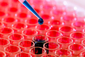 هشدار در مورد افزایش سرطان در کشور/ارائه جدیدترین دستاوردها در حوزه انکولوژی 