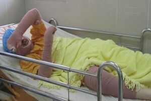 واکنش ها به مرگ دختر آبی در اثر خودسوزی