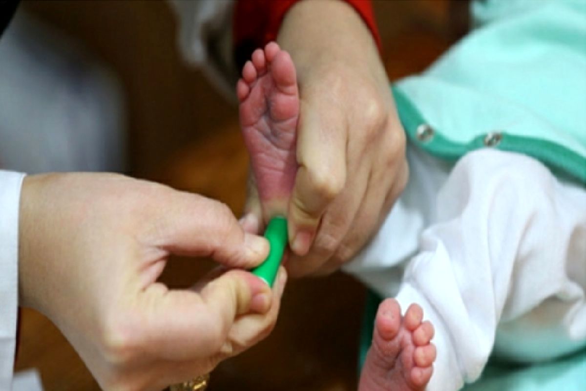 غربالگری تیروئید نوزادان