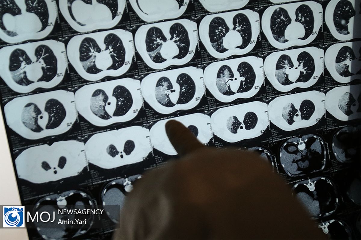 بخش بیماران مبتلا به کرونا بیمارستان گلستان نیروی دریایی ارتش