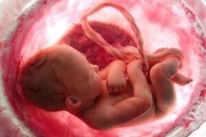 افزایش آمار مجوزهای سقط درمانی در کشور/ مراجعه بیش از ۱۲ هزار نفر برای دریافت مجوز سقط