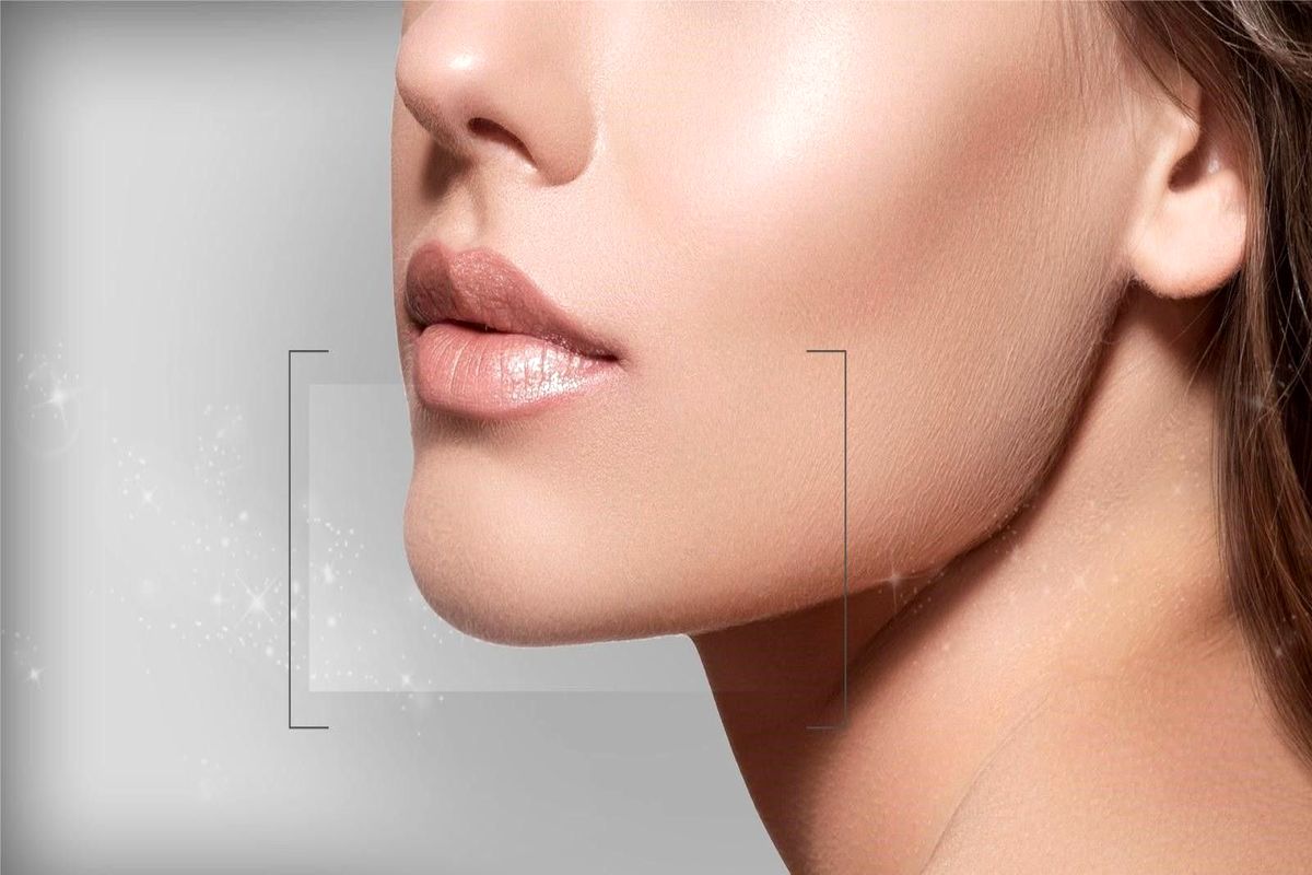 تزریق ژل لب