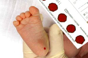 ضرورت آزمایش خون فنیل‌کتونوری برای نوزادان 