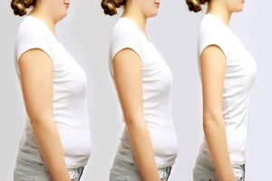 بهترین جراح لیپوماتیک در تهران | راهنمای کامل انتخاب جراح حرفه‌ای