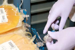 وام ۱۰۰ میلیاردی برای تولید فرآورده‌های پلاسمایی