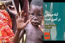 موارد مشکوک ابتلا به آبله میمون در مراکش هم شناسایی شد