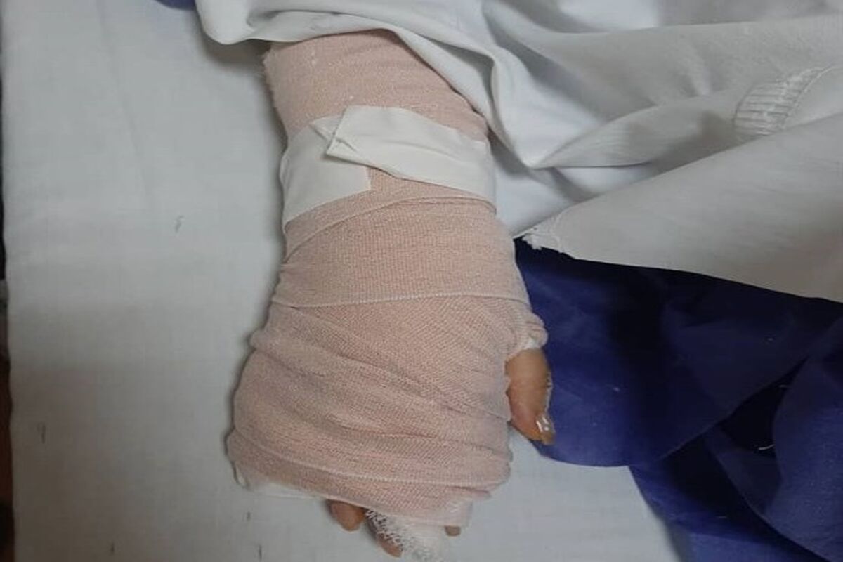 دست شکسته