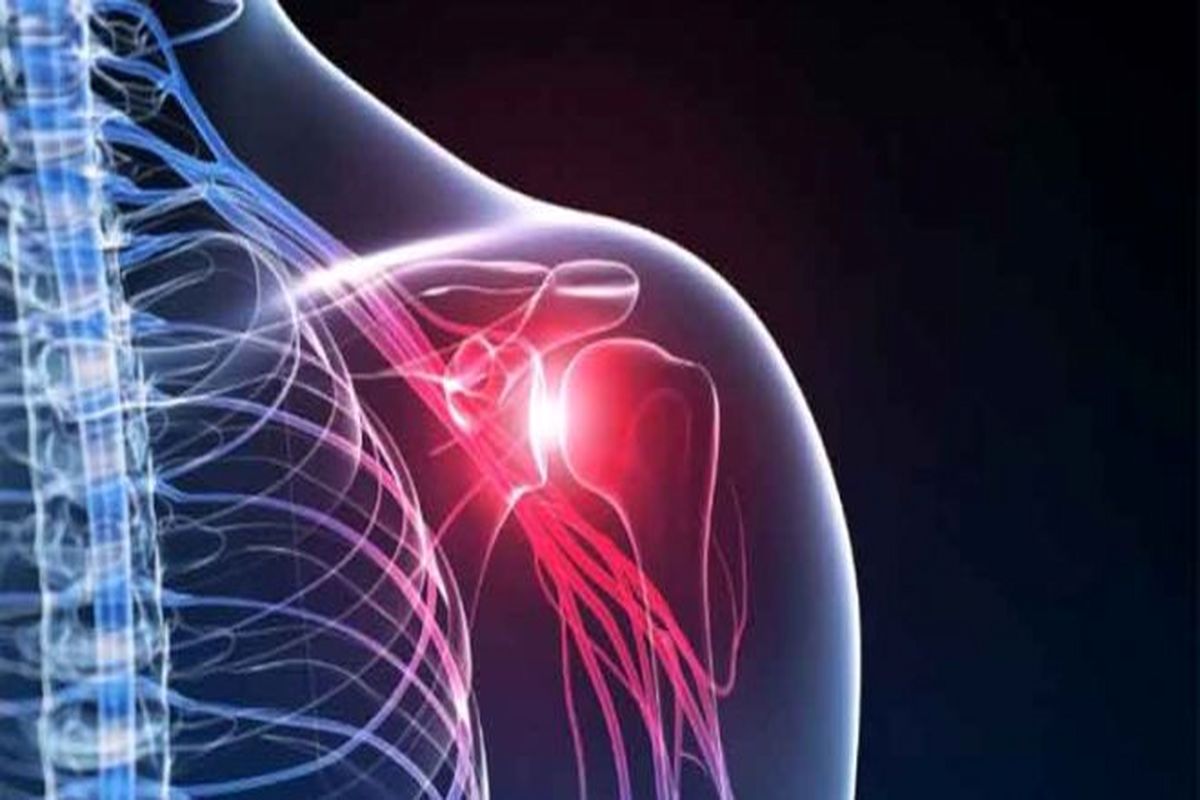 شانه‌های منجمد